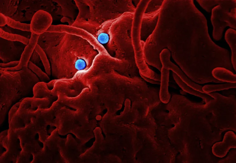 get rid bad bacteria